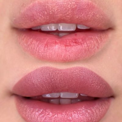Lip Blush Procedure