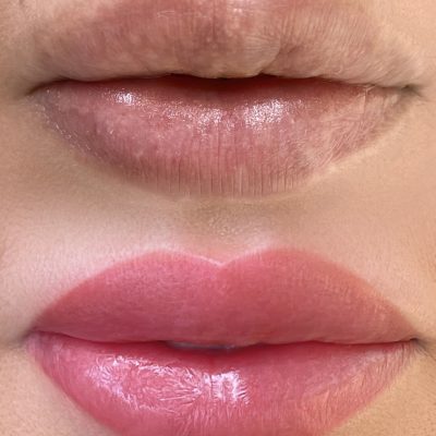 Lip blush treatment