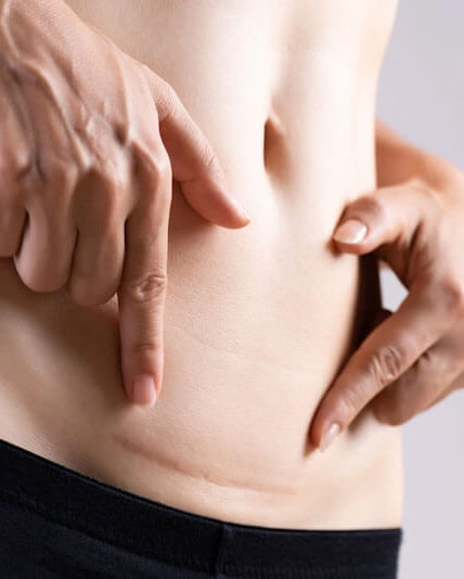 scalp-micropigmentation-1